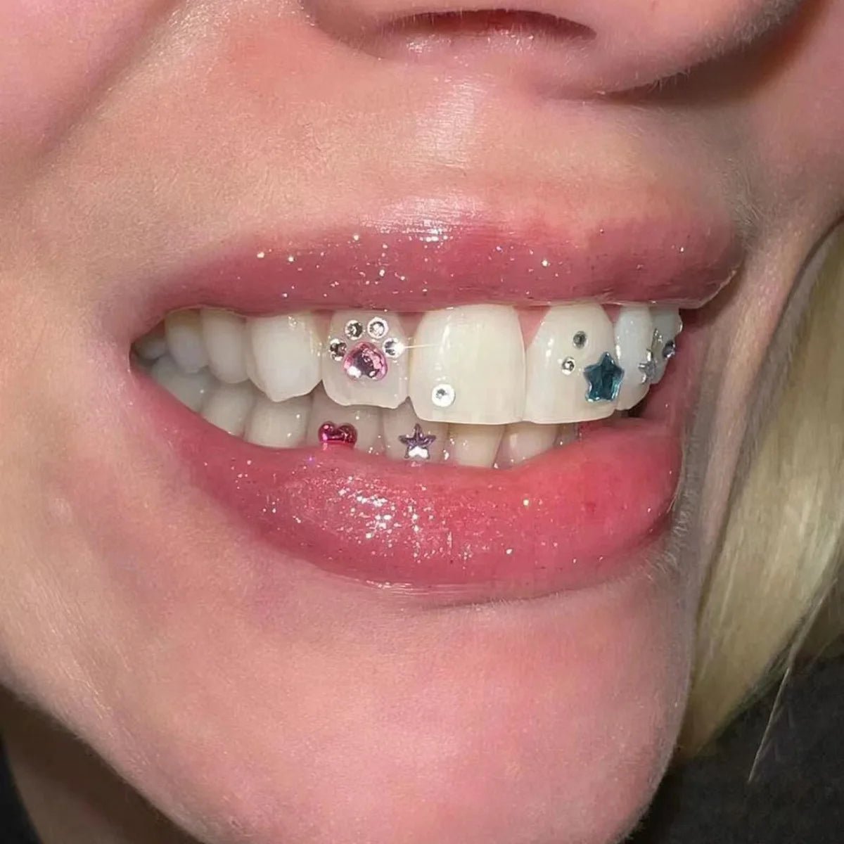 Tooth Gems Rhinestone Tooth Beauty Diamond Jewelry Crystal Diamond Jewelry Tooth Jewelry - QIAO CrystalQIAO CrystalQIAO Crystal